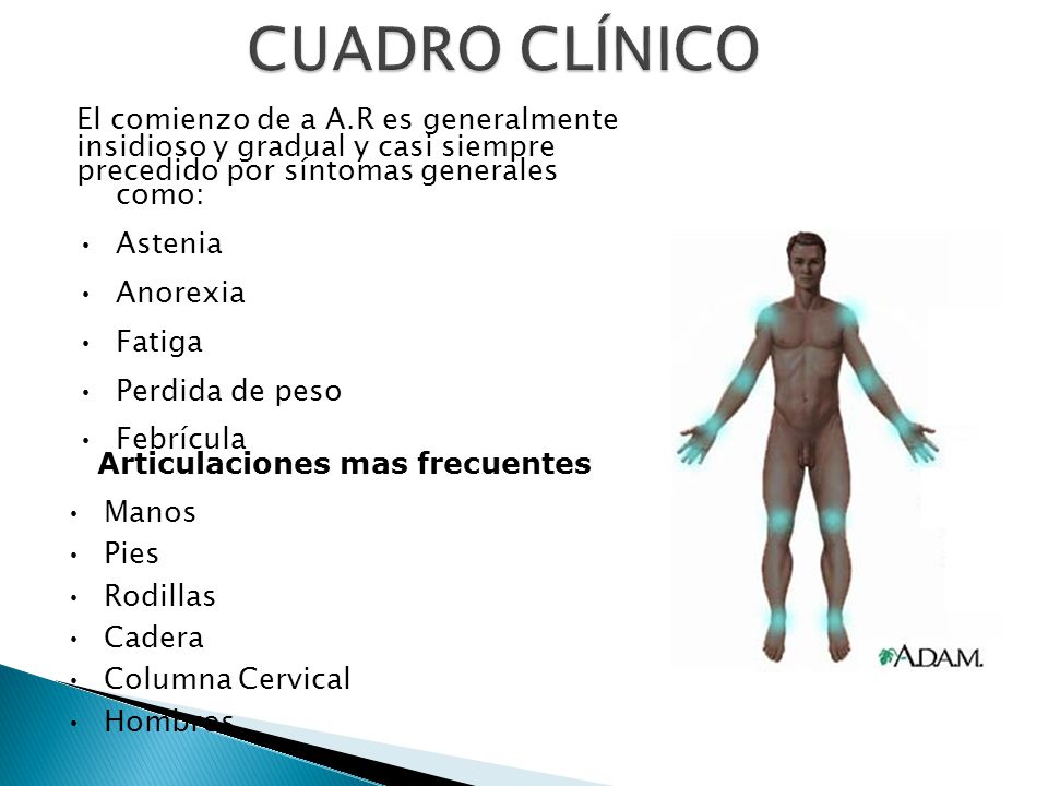 Perdida de peso por artritis reumatoide